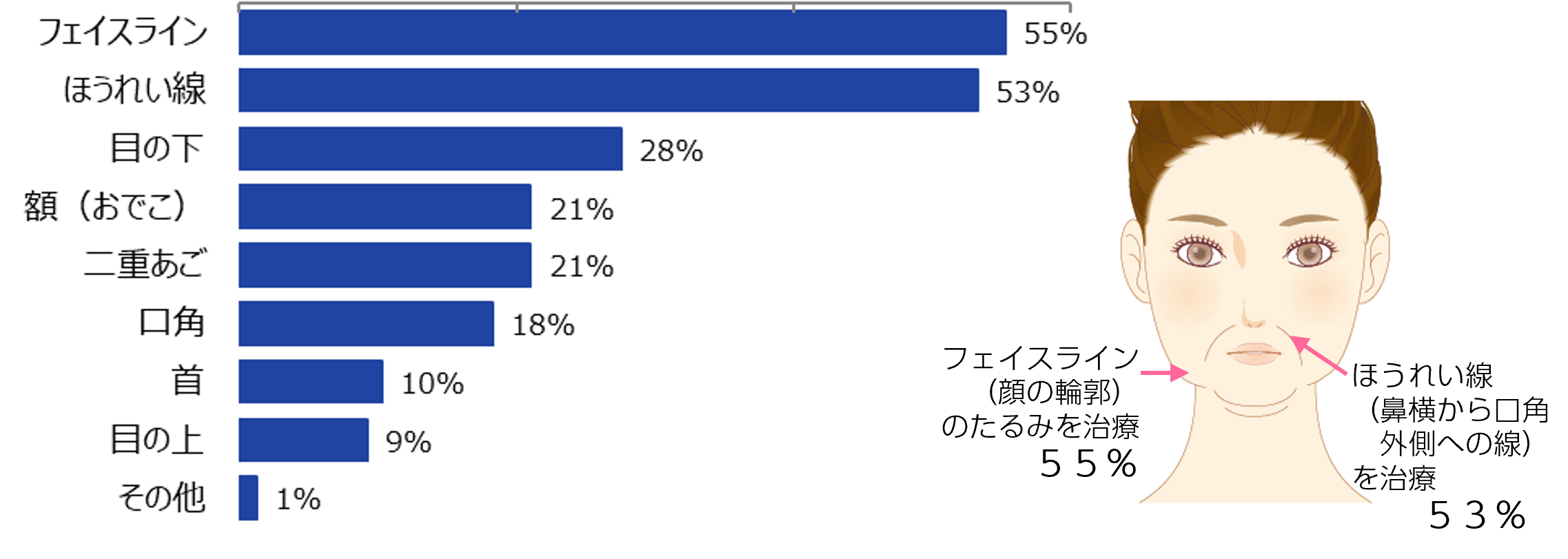 フェイスライン（輪郭）とほうれい線のたるみ治療を受ける方が半数以上と判明。