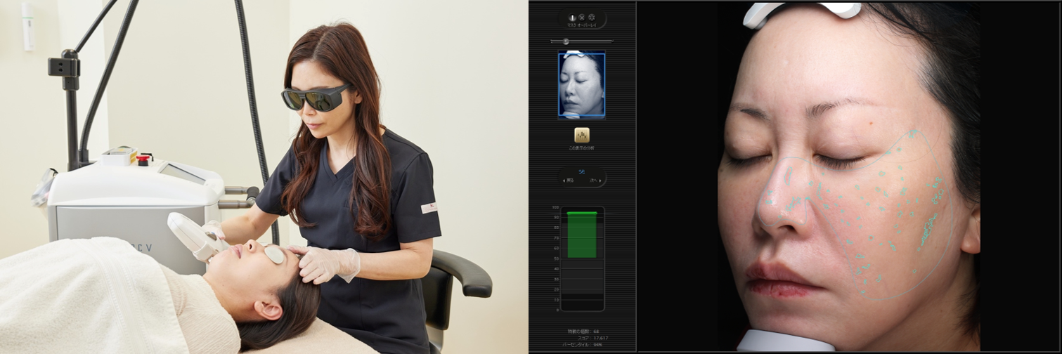 「保湿ケアを強化」が66.0％で最多